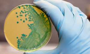 Клебсиелла (Klebsiella): характеристика и патогенность, проявления, терапия и профилактика