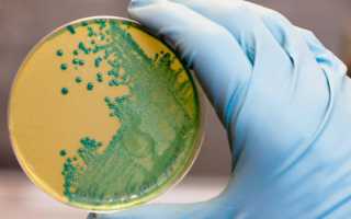 Клебсиелла (Klebsiella): характеристика и патогенность, проявления, терапия и профилактика