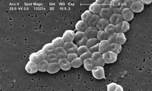 Acinetobacter: характеристика, патогенность, симптоматика, диагностика, лечение и профилактика