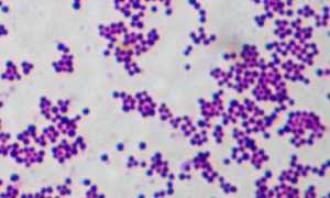 Staphylococcus aureus: характеристика, патогенность, диагностика, как лечить и профилактика