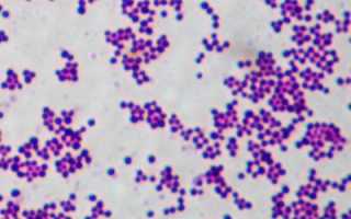 Staphylococcus aureus: характеристика, патогенность, диагностика, как лечить и профилактика