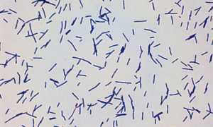 Lactobacillus: свойства, характеристика, диагностика, патогенность и их значение