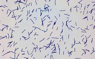 Lactobacillus: свойства, характеристика, диагностика, патогенность и их значение