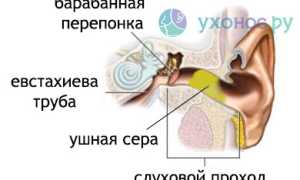 Пробки в ушах: как удалить в домашних условиях и у врача, советы и рекомендации