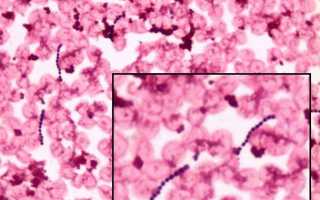 Streptococcus mitis: характеристика, патогенность, симптомы, лечение и профилактика