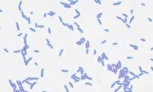 Eubacterium: характеристика, патогенность, симптоматика, диагностика, лечение и профилактика
