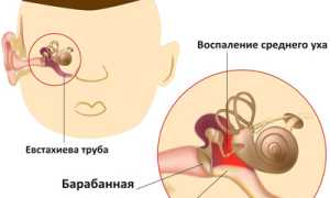 Продуло ухо: выявление, заболевания-последствия и их лечение для здоровья