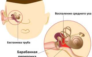 Продуло ухо: выявление, заболевания-последствия и их лечение для здоровья