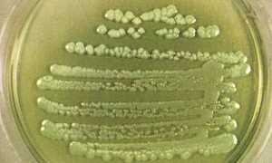 Pseudomonas: свойства, характеристика, патогенность, симптоматика, диагностика, как лечить и профилактика