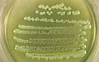 Pseudomonas: свойства, характеристика, патогенность, симптоматика, диагностика, как лечить и профилактика