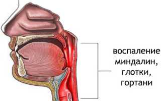 Парагрипп: причины, признаки, диагностика, как лечить и профилактика заболеваний
