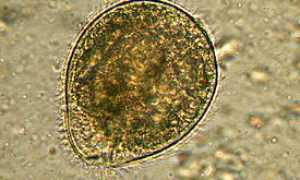 Балантидиаз и Balantidium coli: характеристика и заражение, течение, терапия, профилактика и диагностика