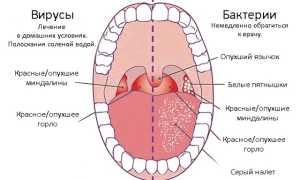 Боль в носоглотке: этиология, болезни и симптоматика, лечение, рекомендации специалистов
