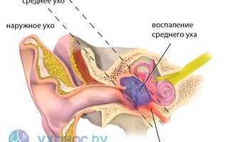 Щелкает и трещит в ушах: причины, симптоматика, лечение и советы