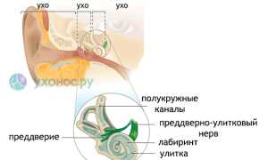 Лабиринтит (воспаление внутреннего уха): как лечить, причины и профилактика