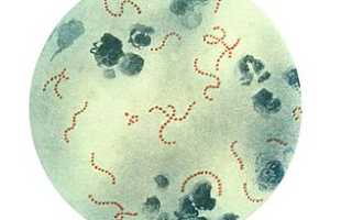 Streptococcus pyogenes: характеристика, что вызывает, симптомы, лечение и профилактика