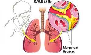 Сиропы от кашля: фармакологические группы и их действие, показания, обзор наименований и рекомендации