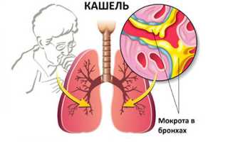 Сиропы от кашля: фармакологические группы и их действие, показания, обзор наименований и рекомендации