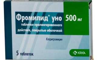 Лекарства для лечения пневмонии и бронхита: как обеспечить их эффективность и безопасность