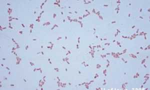 Serratia: патогенность, диагностика, симптомы, лечение и профилактика инфекционных заболеваний