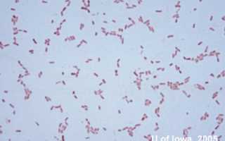 Serratia: патогенность, диагностика, симптомы, лечение и профилактика инфекционных заболеваний