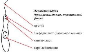 Лейшманиоз: понятие, формы, симптомы и диагностика, лечение заболеваний