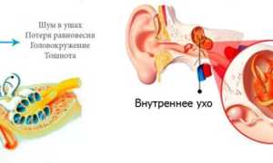 Вестибулопатия: как возникает, формы, проявления, диагностика, как лечить и профилактика