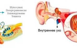 Вестибулопатия: как возникает, формы, проявления, диагностика, как лечить и профилактика