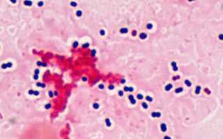 Streptococcus pneumoniae: характеристика, патогенность, диагностика, лечение и профилактика