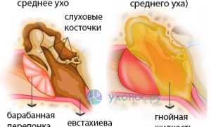 Течет из уха: причины, виды и характер выделений, диагностика, лечение, советы специалистов