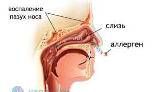 Отек носа: причины, симптомы и формы, как снять и лечить эффективно