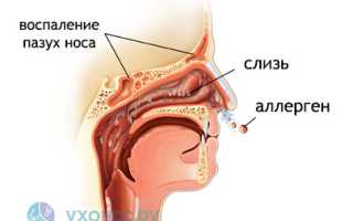 Отек носа: причины, симптомы и формы, как снять и лечить эффективно