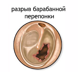 55110390490