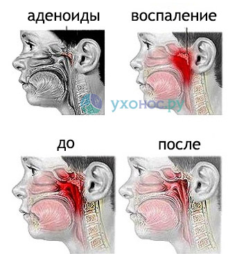 5934000