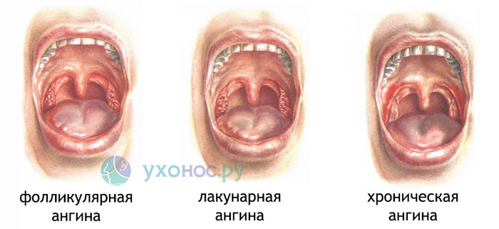 798798977987878