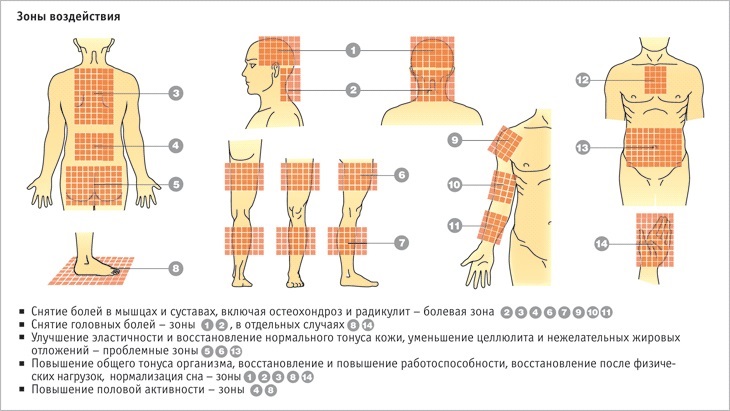 Точки и методы воздействия на них иглоукалывание при остеохондрозе поясничного отдела