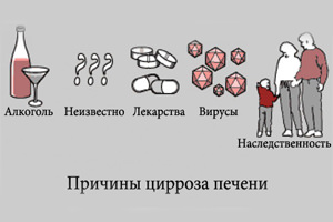 причины цирроза печени