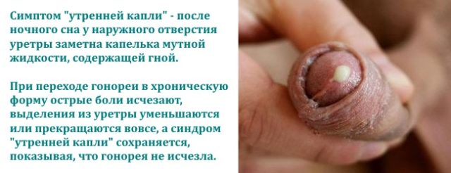 гной из члена