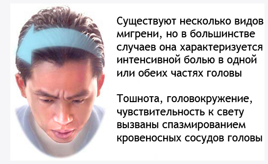мигрень причины